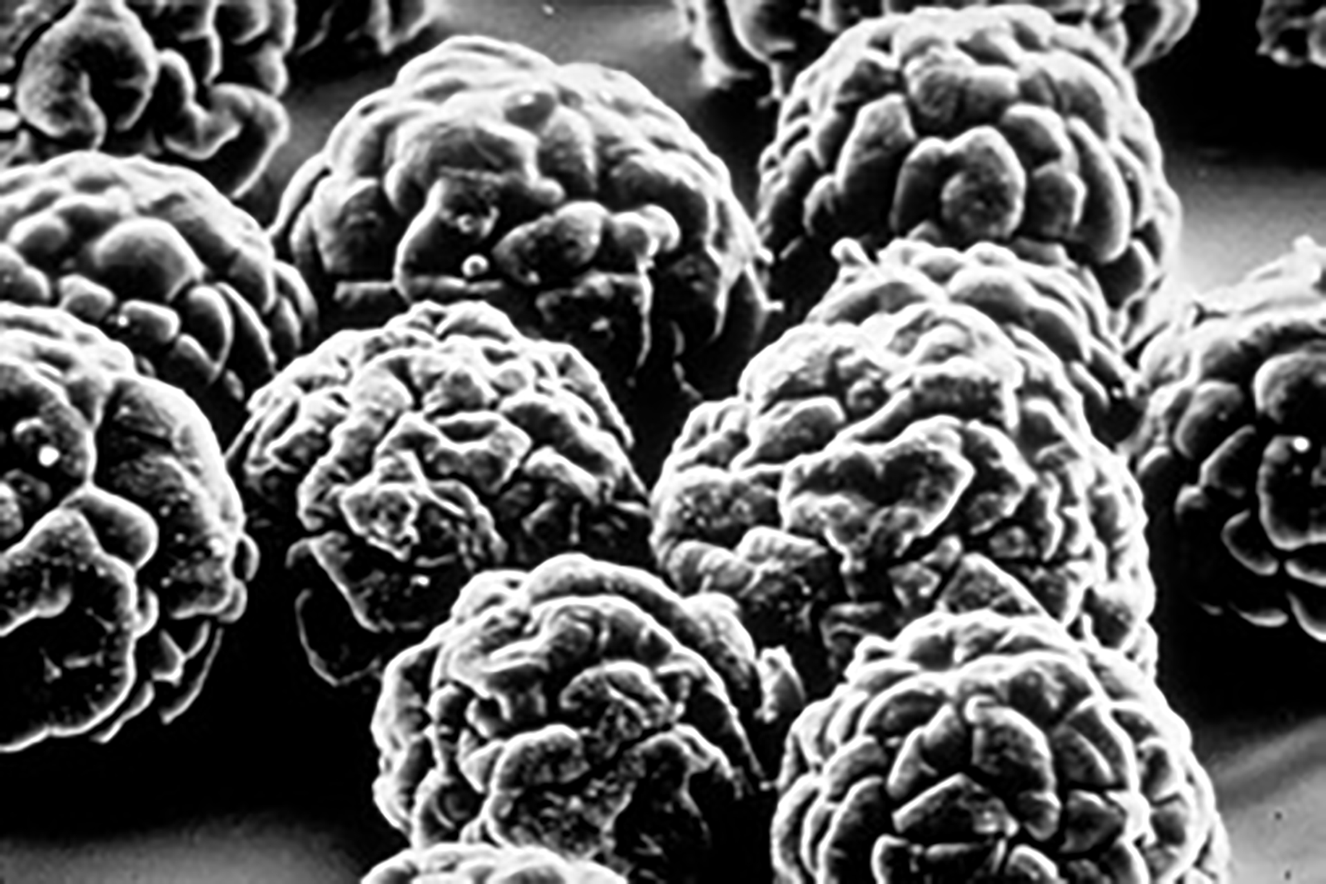Alerta internationala OMS, privind virusul polio salbatic, la granita Romaniei