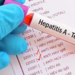 Peste 500 de cazuri de hepatita virala A, confirmate, in judetul Bihor. Dublu fata de anul 2017