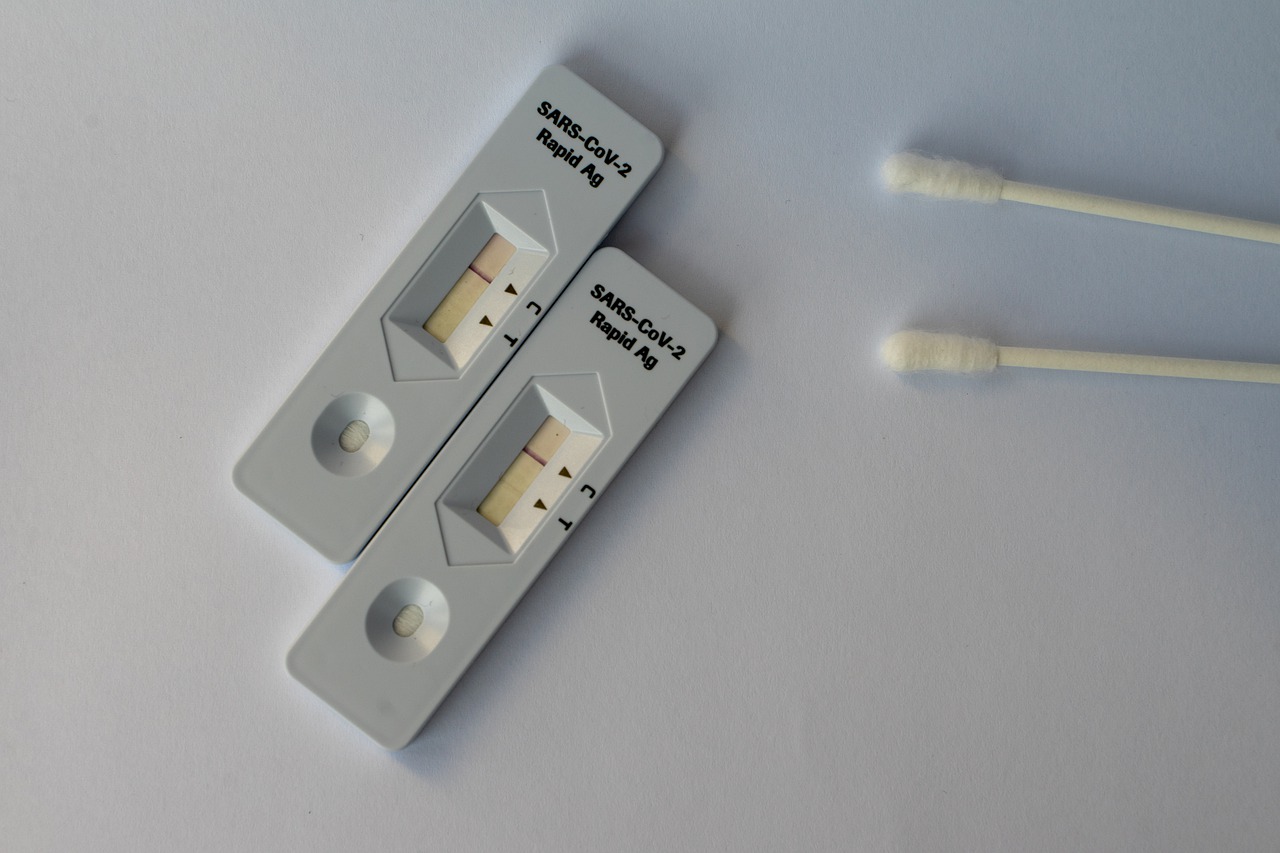 DSP Bihor efectueaza teste antigen la 50 lei testul, cu rezultat imediat. Vezi lista centrelor de testare din judetul Bihor